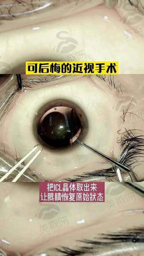 六、真实实例：他们为什么选择医 大眼科？