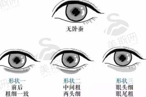 北京张海明做拉皮情况