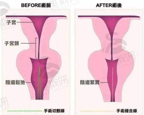 拓展建议