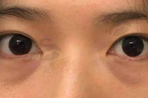 总结