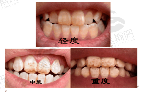 深圳格伦菲尔口腔地址及就诊指南
