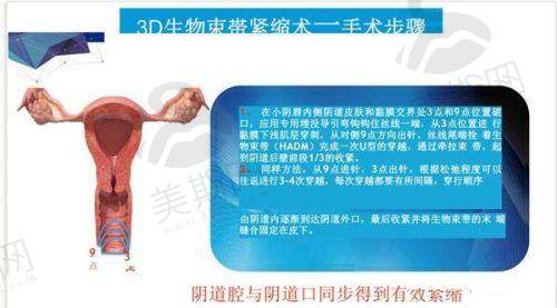 牛永敢医生在哪里可以预约？揭秘其所在医院、郑州坐诊情况及预约地址！