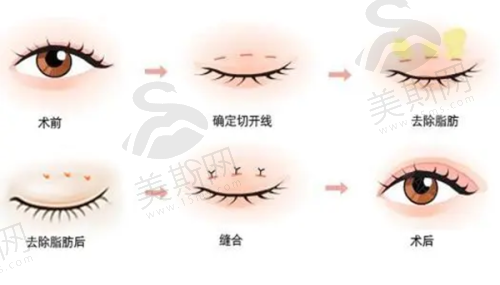 深圳整形医院价格表