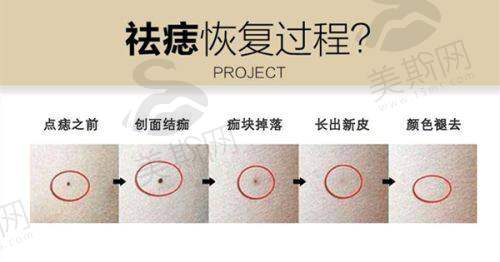 总结