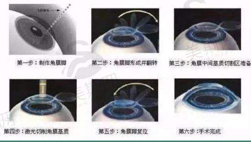 徐州市第一人民医院眼科正规吗？