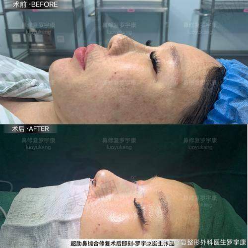 总结