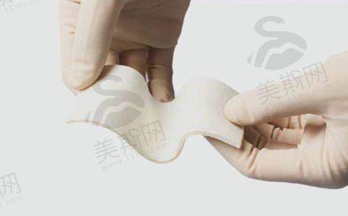 李光琴做双眼皮修复怎么样