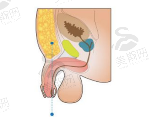 韩国VSLine皮肤科江南店热门项目价格表