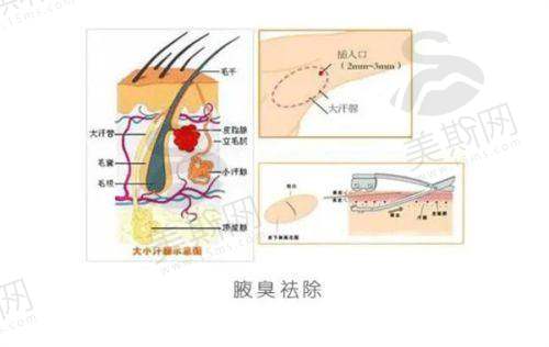广州正颌手术价格的影响因素有哪些
