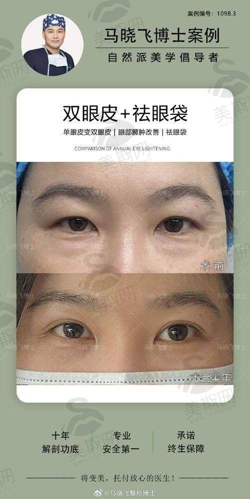 9、重庆双眼皮医生排名第九——张一鸣