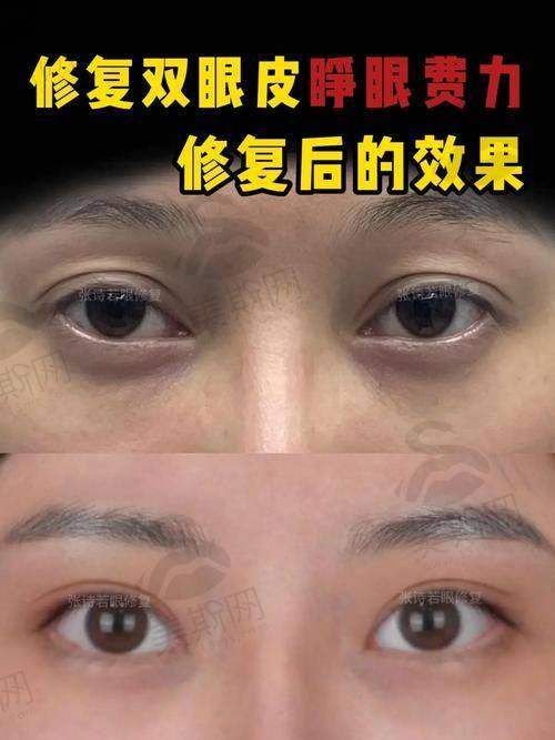 二、选医生的“黄金3标准”：专攻修复+疤痕处理+审美同频，比“医生头衔”更重要