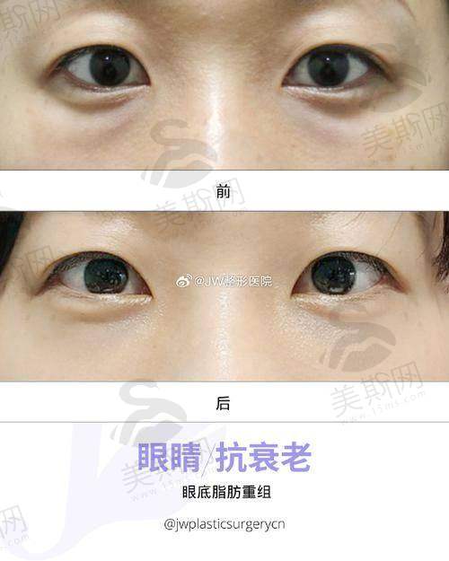 胶原绷带可持续多久？2025胶原3.0实测：28天修护屏障宝妈反馈超预期！