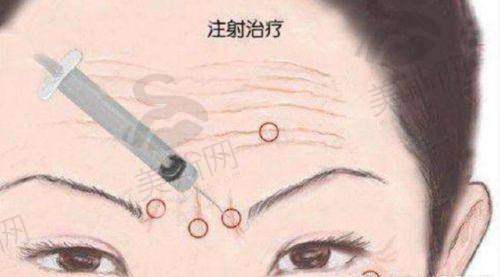 2025年薇旖美省钱攻略:3招立省30%