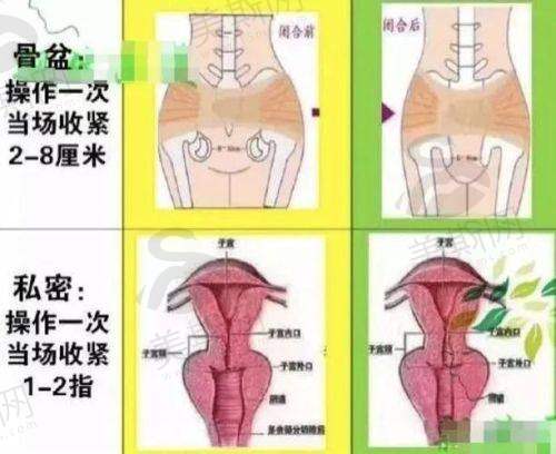生殖医生在线询问24小时免费:适合人群自测(30秒对号入座)