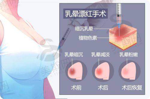 生殖医生在线询问24小时免费：总结+行动指南
