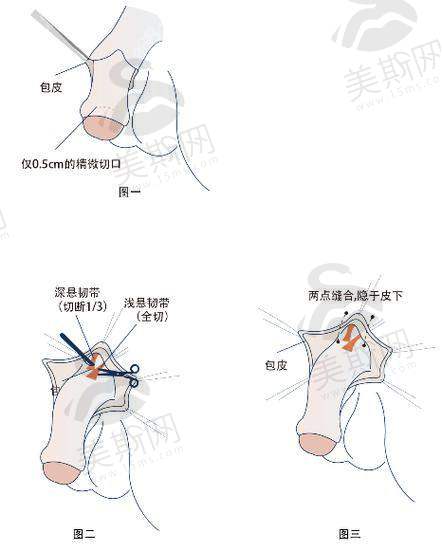 男科在线免费询问留电话预约避坑指南：3步辨别正规平台，远离“黑中介”