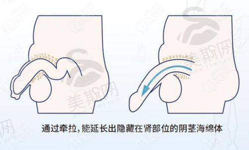 生殖医生在线询问24小时免费：3大核心问题一次讲透（附真人询问记录）