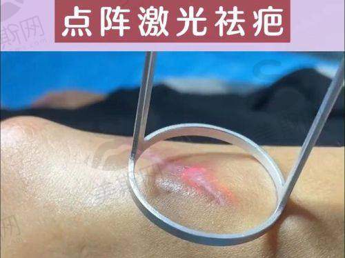 四、重庆疤痕修复技术优势