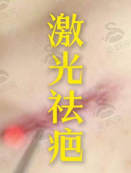 2.2 手术修复：3.8万元起的终极解决方案