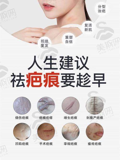3.3 重庆三峡中 心医院疤痕修复价格表