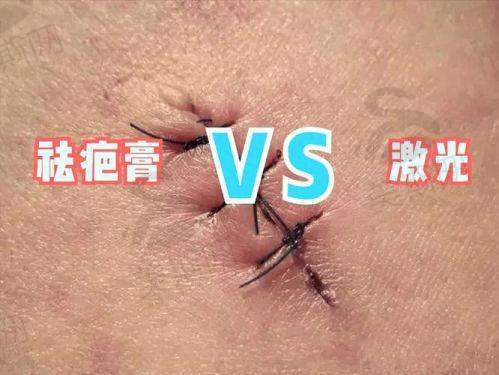 五、重庆疤痕修复口碑实例