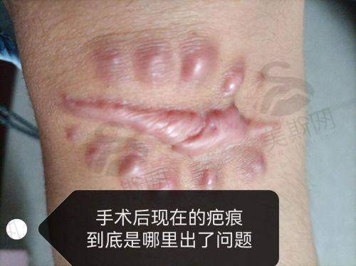 2.3 综合治疗方案：性价比之选