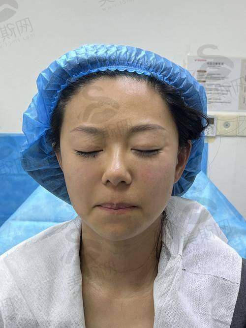 百映妍实际成效如何?真实用户实例+临床数据
