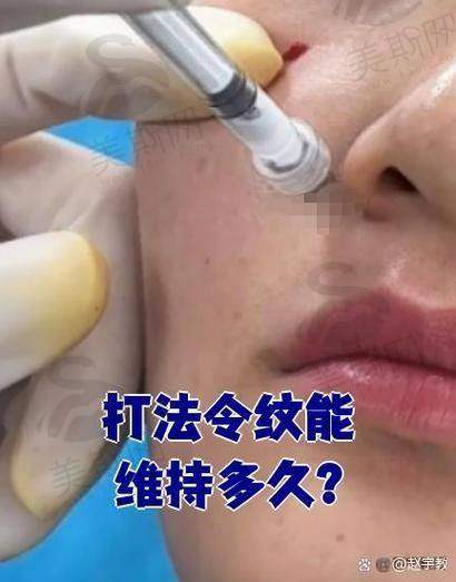 百映妍打针真实实例:35岁张女士如何通过疗程改善松弛?