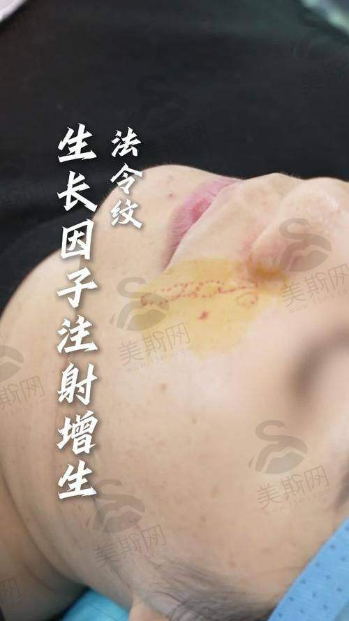 修护型胶原绷带多久有成效？28天实测数据来了