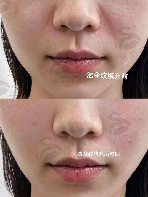 百映妍属于什么档次?从价格和定位看行业地位