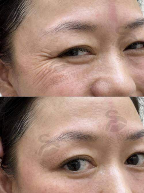 百映妍是杂牌还是名牌?属于什么档次?2025正规品牌深度解析