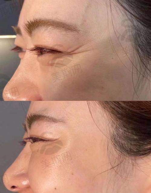薇旖美胶原蛋白真人实例:3种肤质实测维持时间,看看哪种和你一样