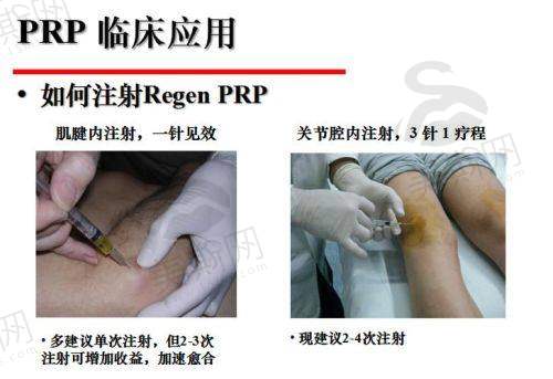 百映妍打针后维持12个月以上的秘诀:术后护理 + 疗程坚持