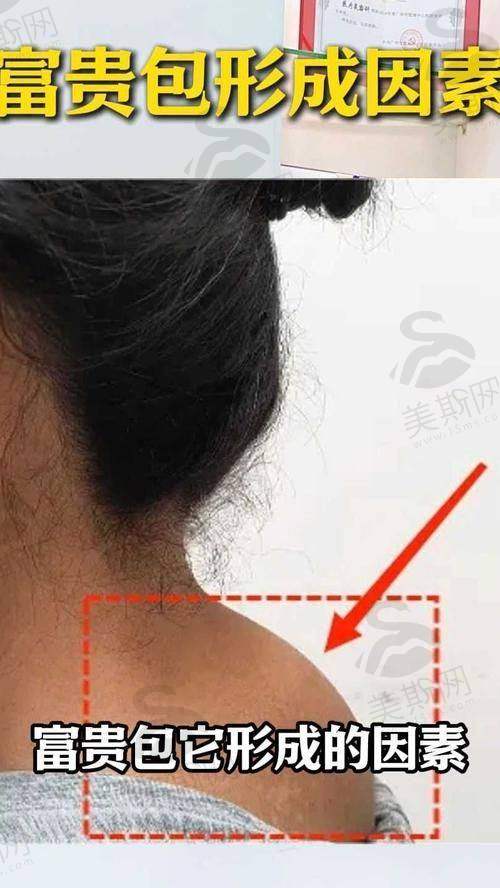 胶原绷带能替代医美吗？皮肤科医生的3句大实话