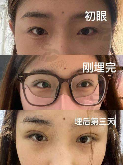 六、24小时在线预约流程：3步搞定面诊，比点外卖还方便