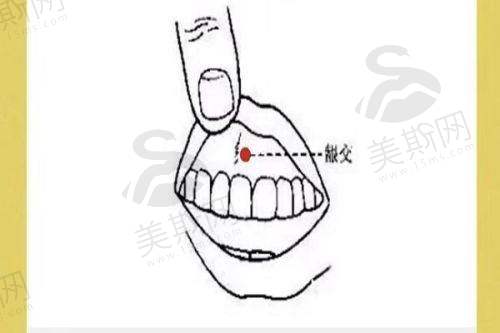苏州其他可打瘦脸针的医院