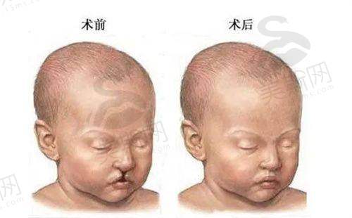 总结