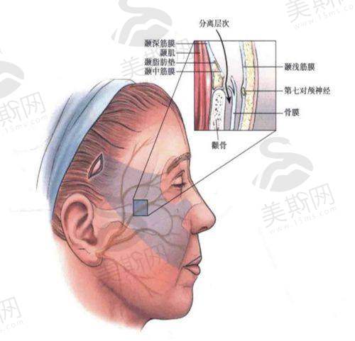 北京海淀区中德植发医院口碑如何