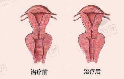 两位王杨医生的患者口碑