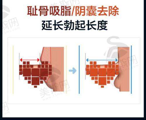 郑州大学第一附属医院生殖医学中 心王杨医生从医经验