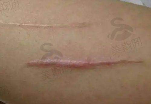 阴道紧缩针预约挂什么科