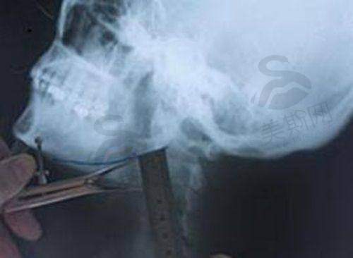 张立彬医生简介