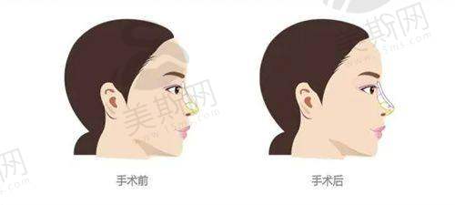 建议与总结
