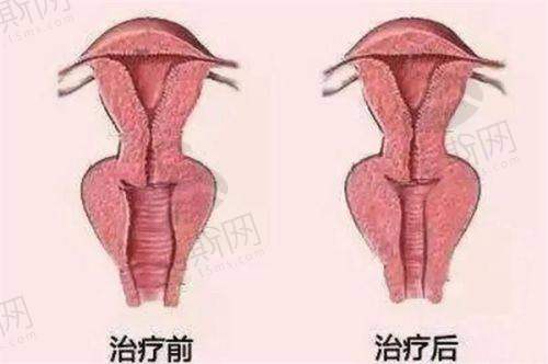 修复技术优势