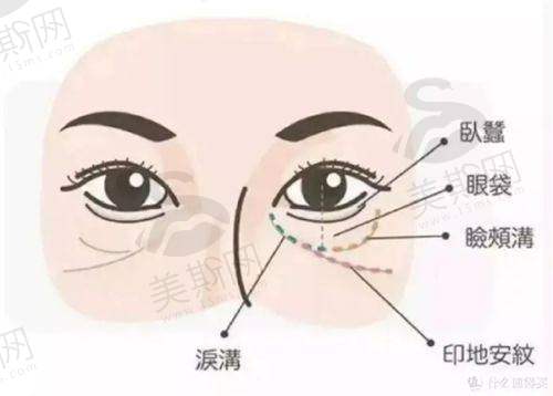 总结