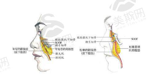 老医美人的选择建议