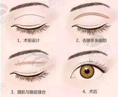 总结