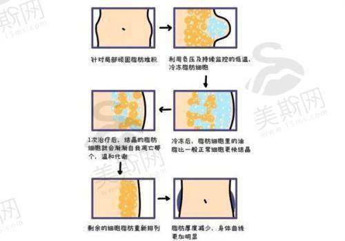 长春面部吸脂哪里好