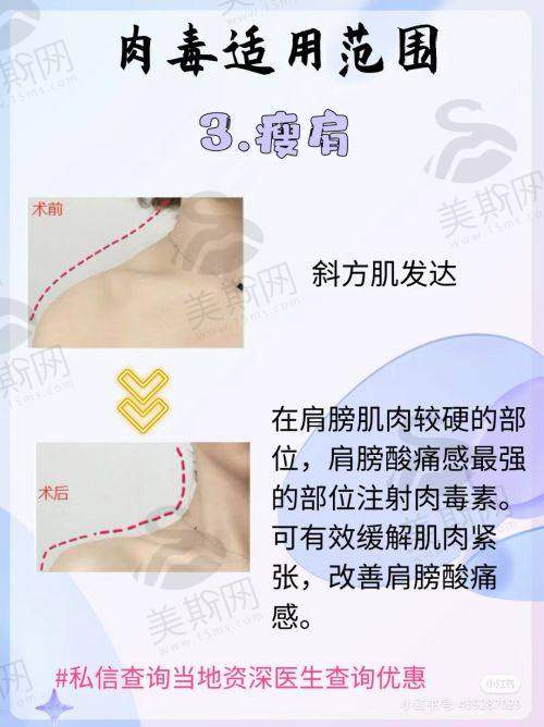 南昌可打紧缩针的医院推荐