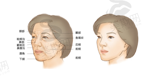 广州私密整形医院价格参考